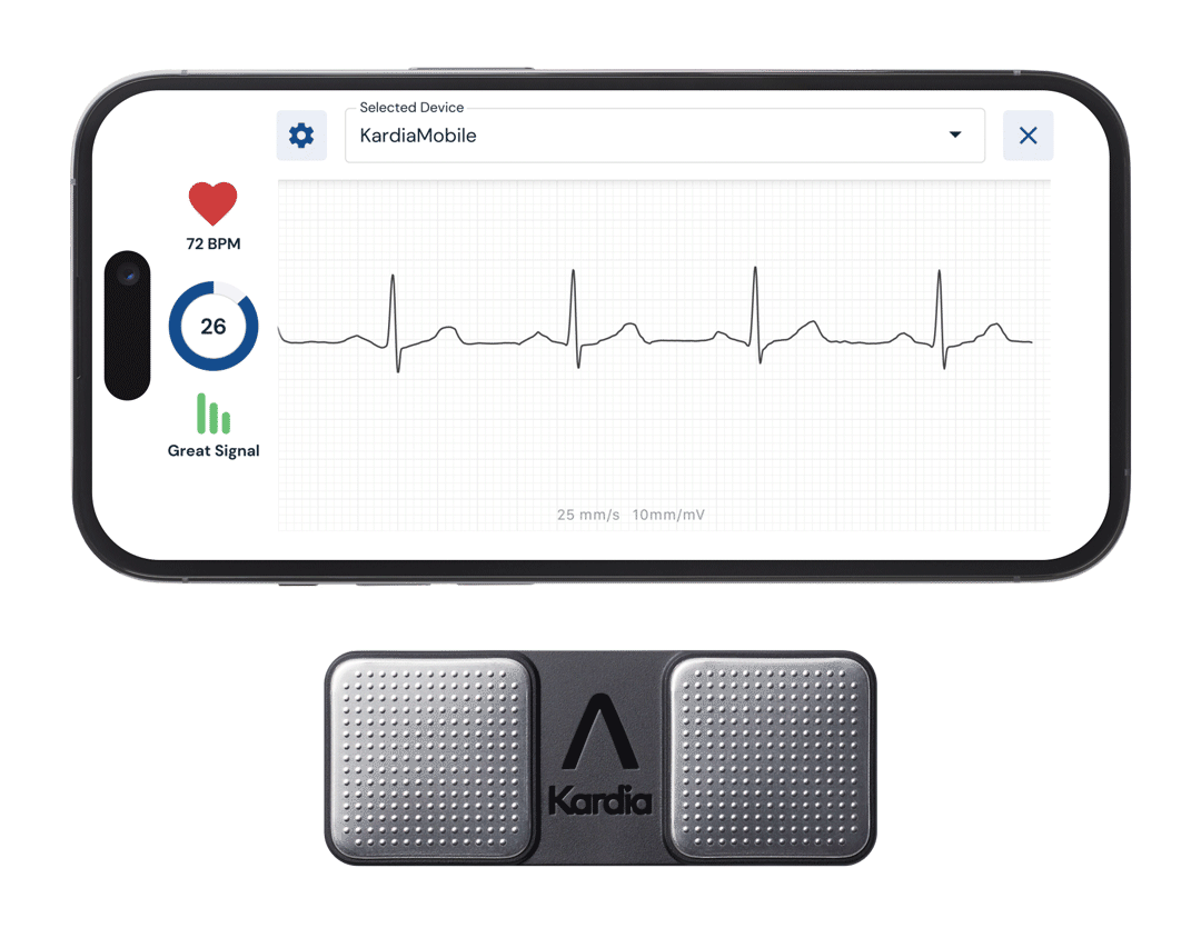 Record an ECG in seconds