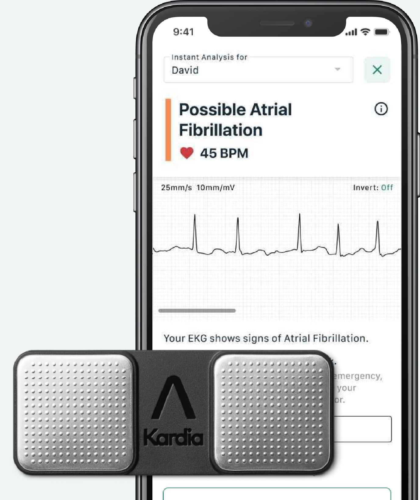 Kardia Instant Analysis screen showing Possible Atrial Fibrillation with a KardiaMobile